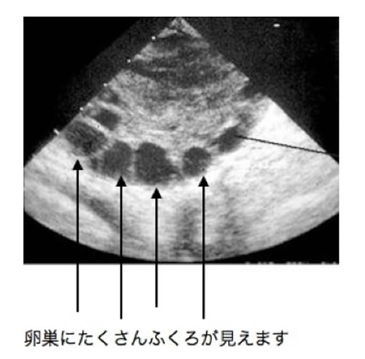 AMH検査とは 年齢とAMH