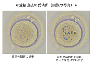 受精直後の受精卵