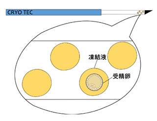 凍結イラスト